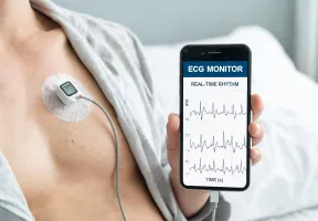 Wearable ECG patch